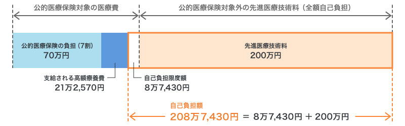 先進医療の技術料の自己負担例